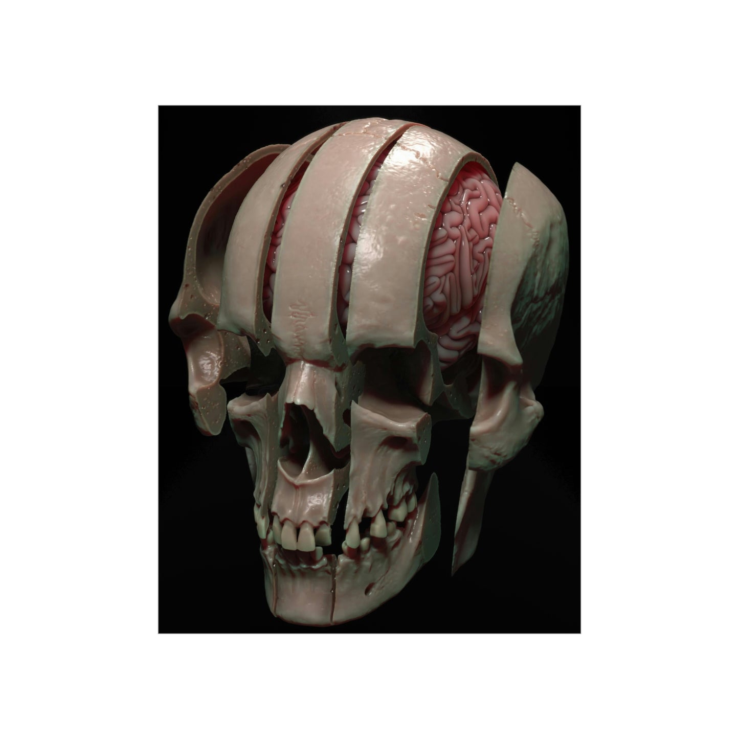 Splitting Headache NFT v1 Premium Matte Vertical Posters