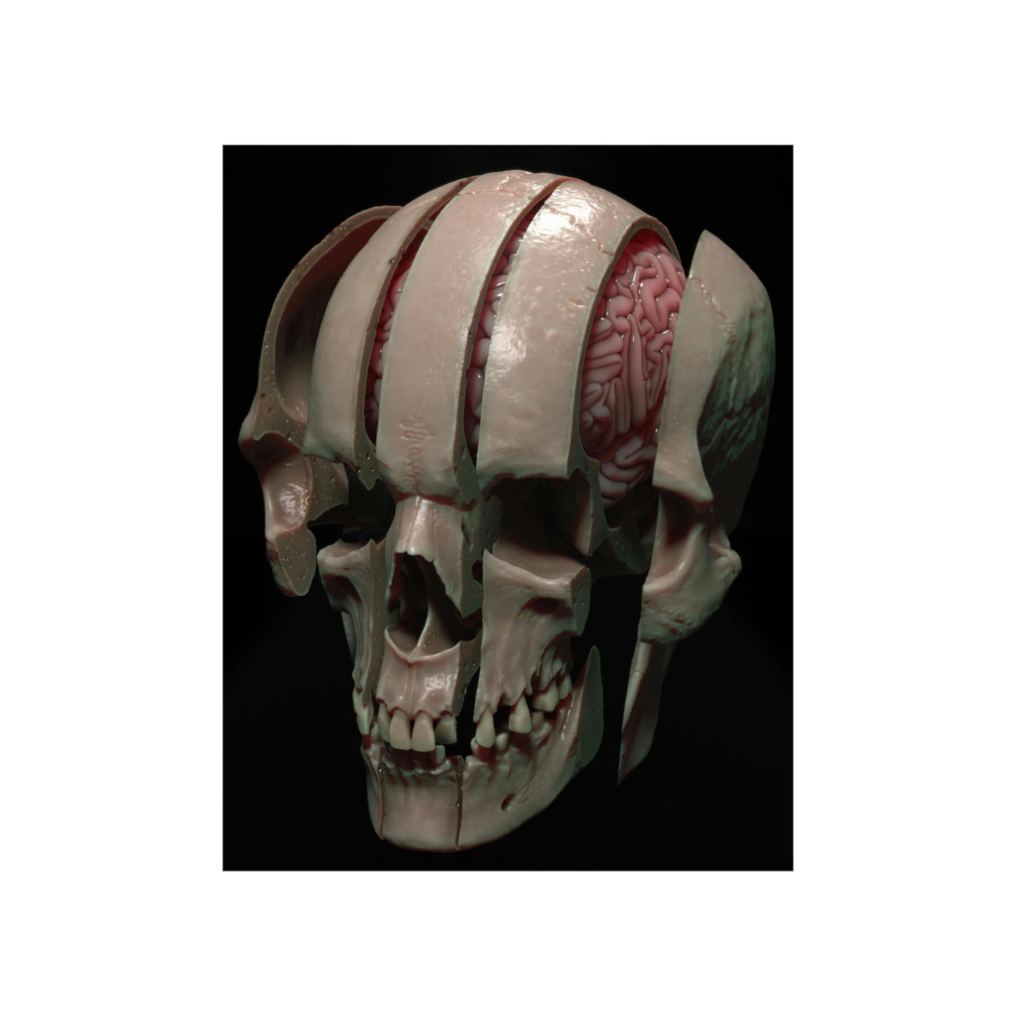 Splitting Headache NFT v1 Premium Matte Vertical Posters