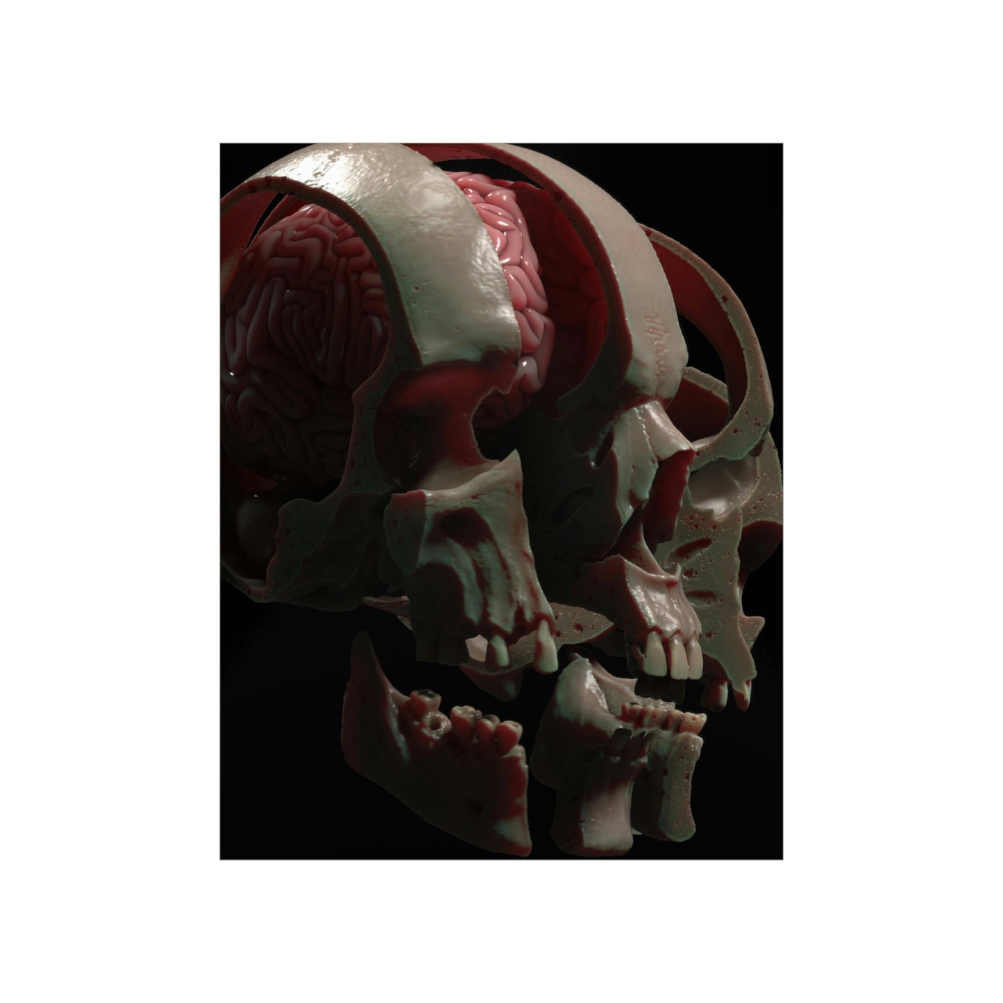 Splitting Headache NFT v2 Premium Matte Vertical Posters